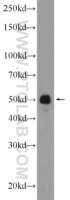 Anti-ST6GAL1 Rabbit Polyclonal Antibody