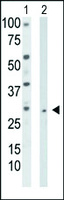 Anti-TK2 Rabbit Polyclonal Antibody