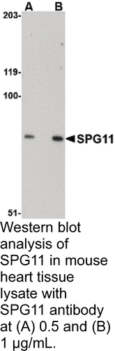 Antibody SPG11 0.1MG