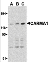 Anti-CARD11 Rabbit Polyclonal Antibody