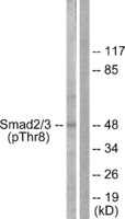 Anti-Smad2 + Smad3 (phospho Thr8) Rabbit Polyclonal Antibody