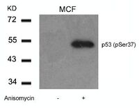 Anti-TP53 Rabbit Polyclonal Antibody
