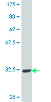 Anti-AGPAT2 Mouse Polyclonal Antibody