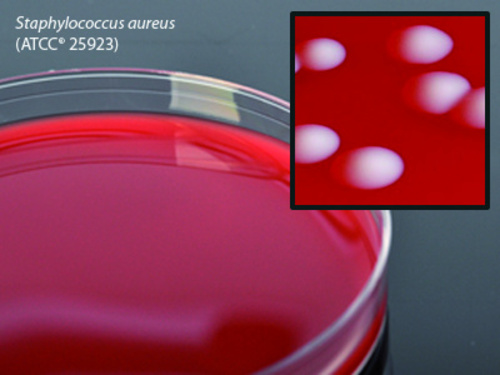 Columbia Blood Agar, 5% sheep, 15x100mm plate, For the cultivation of microorganisms. Pack of 10