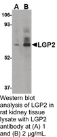 Anti-LGP2 Rabbit Polyclonal Antibody