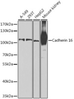 Anti-Cadherin 16 Rabbit Polyclonal Antibody