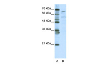 Anti-TAF6L Rabbit Polyclonal Antibody