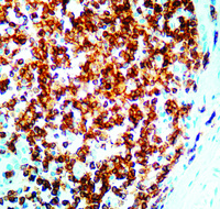Anti-CD3 (T Cell) Rabbit Polyclonal Antibody
