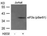 Anti-EIF2S1 Rabbit Polyclonal Antibody