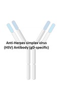 Anti-Herpes Simplex Virus (gD-specific) (HSV) Antibody [clone: RV23]