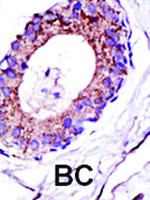 Anti-UBE4A Rabbit Polyclonal Antibody