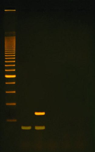 KT RT-PCR:MODEL FORMOLEC BIO OF HIV