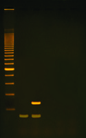 Reverse Transcription PCR (RT-PCR): The Molecular Biology of HIV Replication