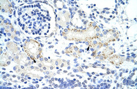 Anti-GTF2IRD1 Rabbit Polyclonal Antibody