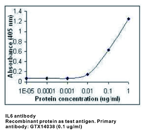 Chicken Polyclonal antibody to IL6 (interleukin 6 (interferon, beta 2))