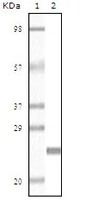 Anti-DES Mouse Monoclonal Antibody [clone: 10H7D2]
