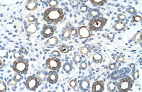 Anti-UBE2J1 Rabbit Polyclonal Antibody