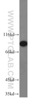 Anti-RRM1 Rabbit Polyclonal Antibody
