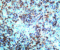 Anti-Bcl-2 Oncoprotein Mouse Monoclonal Antibody [clone: 124]