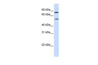 Anti-SLC27A4 Rabbit Polyclonal Antibody
