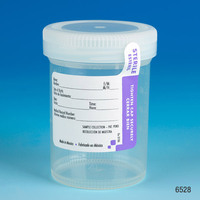 Leak Resistant Urine Collection Containers with Patient I.D. Label, Globe Scientific