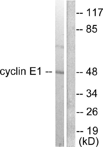 ANTIBODY ANTI-CYCLIN E1 A94771-100 100UG
