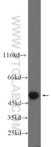 Anti-PSMC3