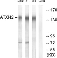 Anti-ATXN2 Rabbit Polyclonal Antibody