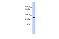 Anti-KLF6 Rabbit Polyclonal Antibody