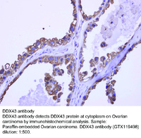 Anti-DDX43 Rabbit Polyclonal Antibody