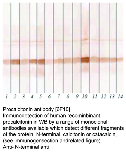 Mouse Monoclonal antibody to Procalcitonin (calcitonin-related polypeptide alpha)