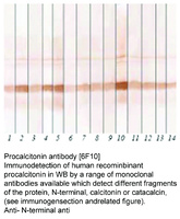 Anti-CALCA Mouse Monoclonal Antibody [clone: 6F10]