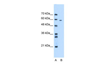 Anti-MDM4 Rabbit Polyclonal Antibody