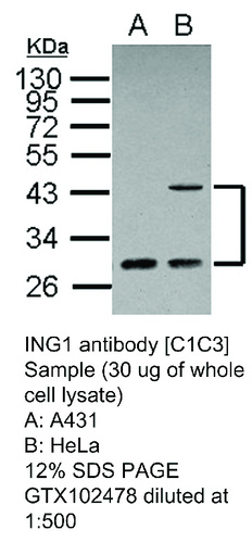 Rabbit Polyclonal antibody to ING1 (inhibitor of growth family, member 1)