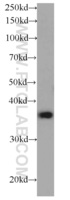 Anti-CAPZA1 Mouse Monoclonal Antibody [clone: 10H1F9]