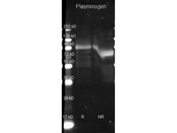 Anti-PLASMINOGEN Goat Polyclonal Antibody (HRP (Horseradish Peroxidase))