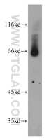 Anti-SLC24A6 Rabbit Polyclonal Antibody
