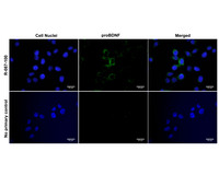 Anti-ProBDNF Rabbit Polyclonal Antibody