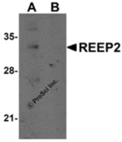 Anti-REEP2 Rabbit Polyclonal Antibody