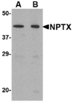 Anti-NPTX2 Rabbit Polyclonal Antibody