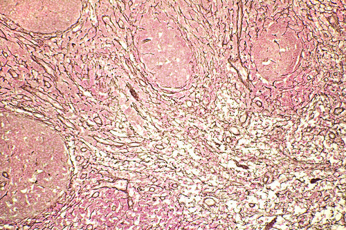 RETICULAR TISSUE  (SECT) M/NFR   M