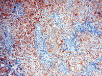 Anti-XPO6 Rabbit Polyclonal Antibody