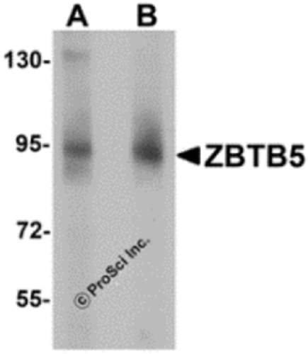 ZBTB5 antibody