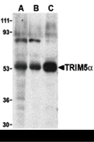 TRIM5 ALPHA antibody