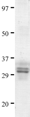 CD4 Fragment Recombinant Protein