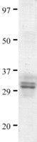 Recombinant Cd4 Fragment (from E. coli)