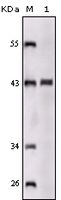 Anti-SORL1 Mouse Monoclonal Antibody [clone: 3B6A9 / 3B6B11]