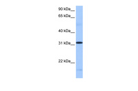 Anti-SRSF10 Rabbit Polyclonal Antibody