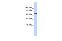 Anti-ATP2B4 Rabbit Polyclonal Antibody
