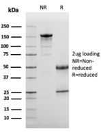Anti-C3d Mouse Monoclonal Antibody [clone: C3D/2891]